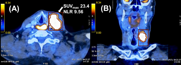 Figure 2