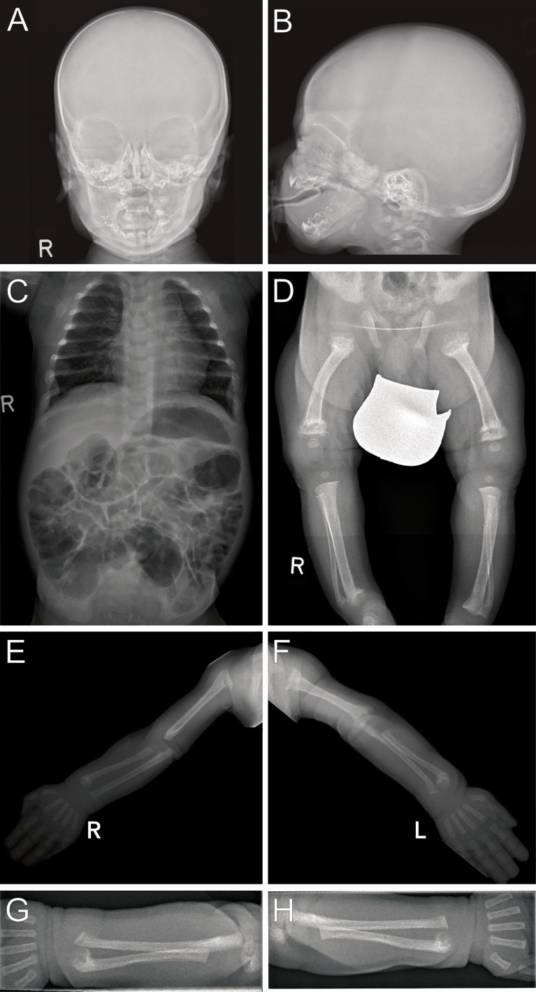 Figure 2