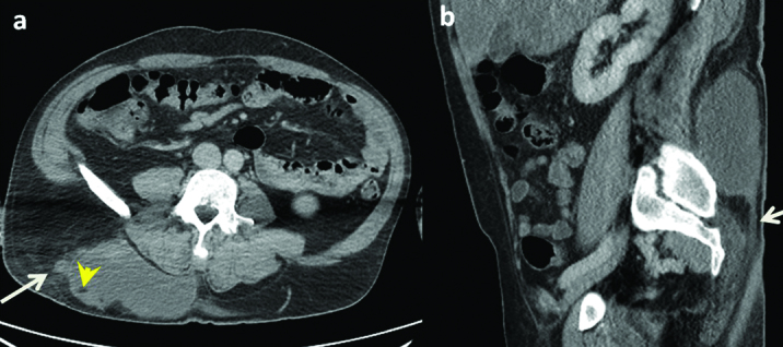 [Table/Fig-3]: