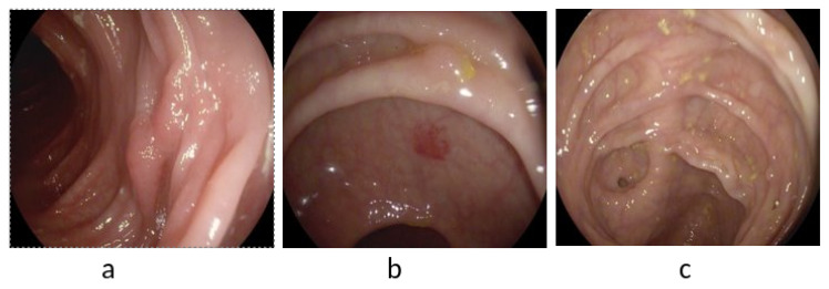 Figure 9