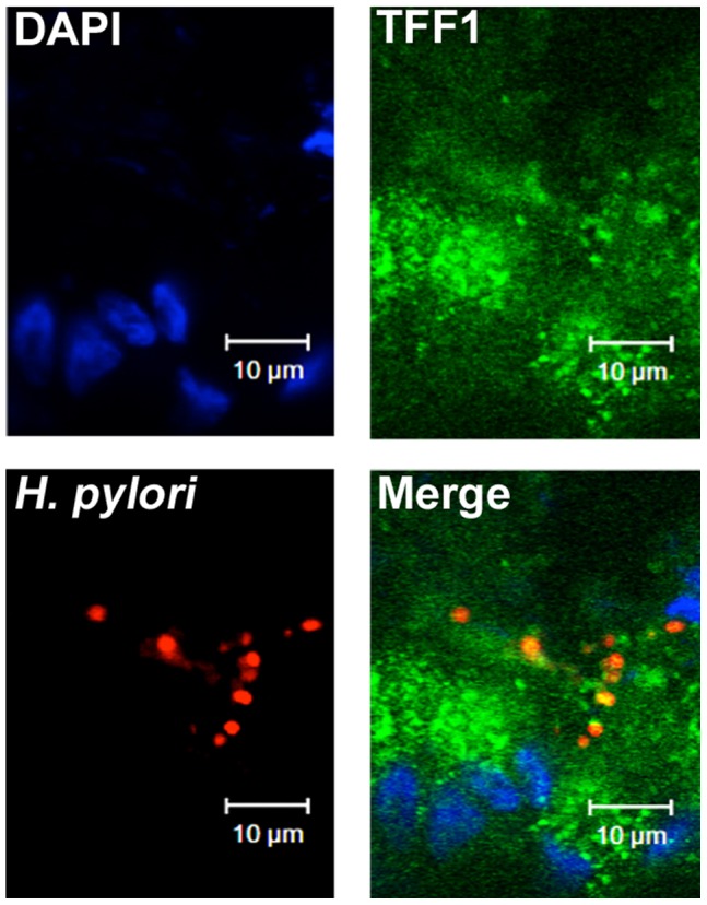 Figure 6