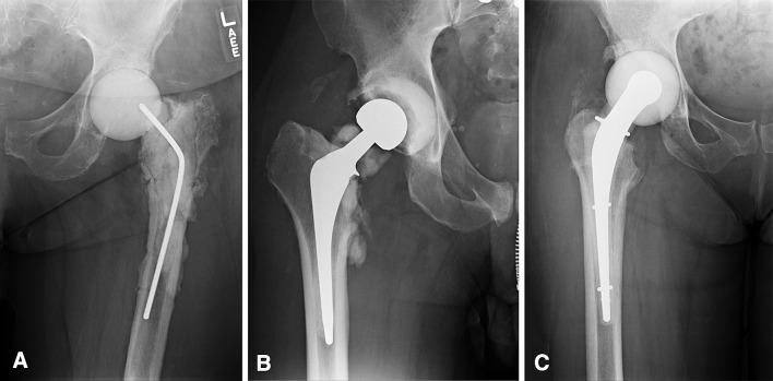 Fig. 2A–C