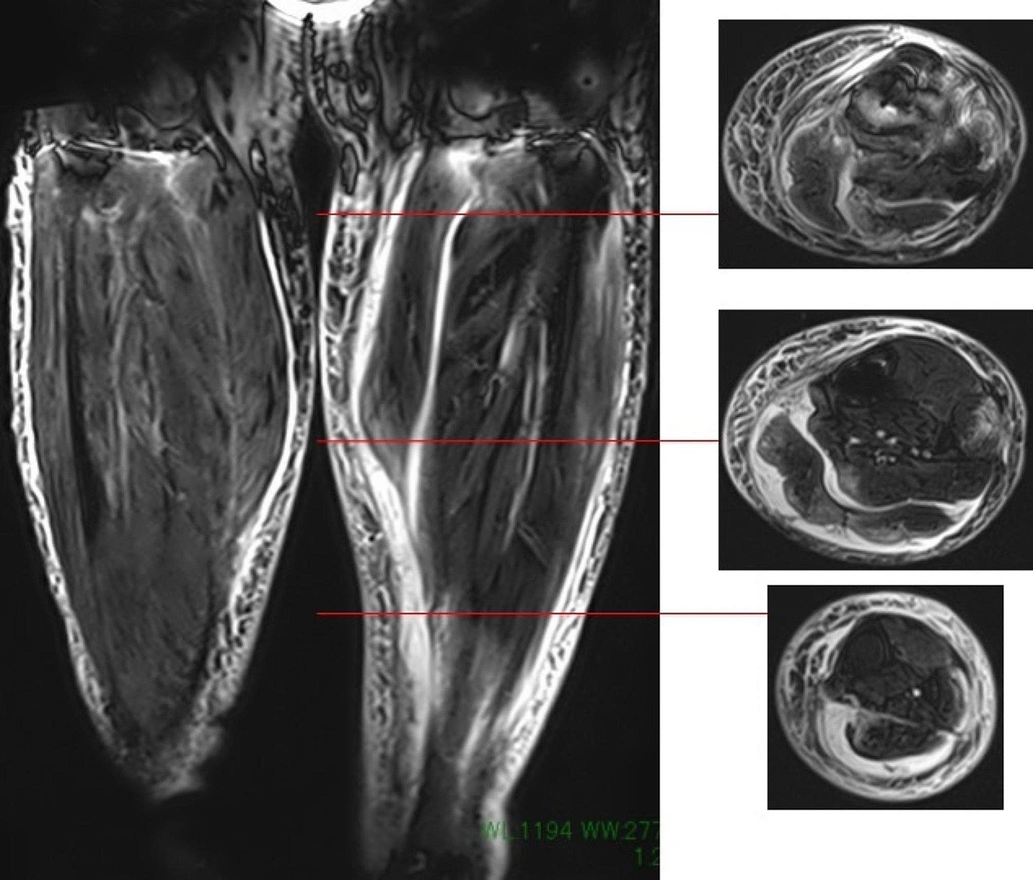 Fig. 2