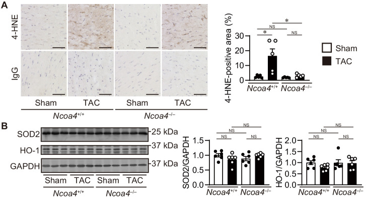 Figure 4—figure supplement 3.