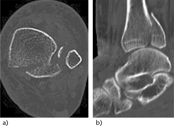 Fig. 4 (a, b)