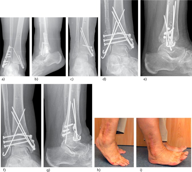 Fig. 7