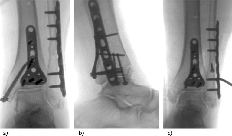 Fig. 5 a, b