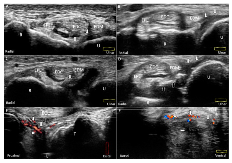 Figure 13