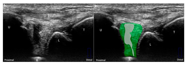 Figure 11