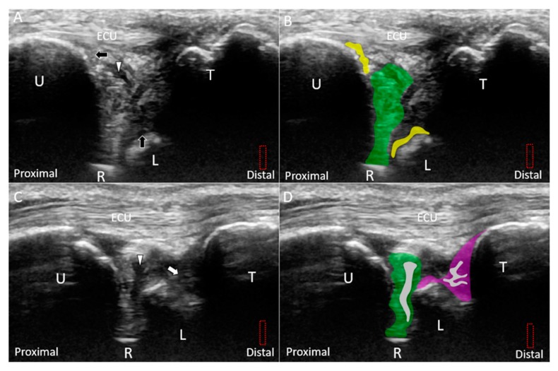 Figure 16