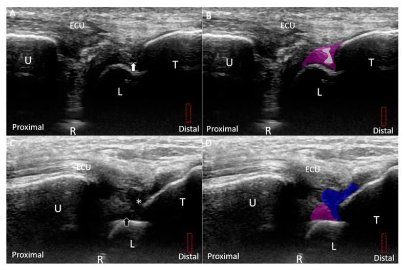 Figure 14