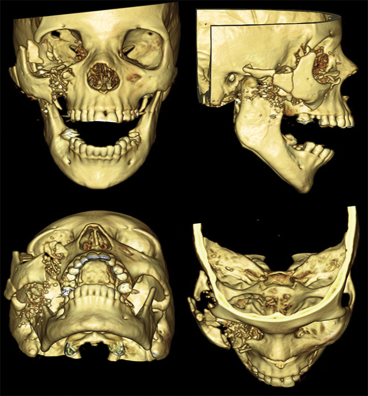 Fig. 4