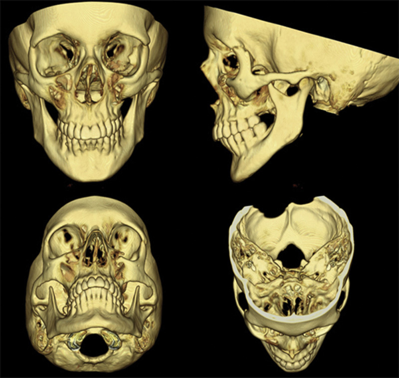 Fig. 3