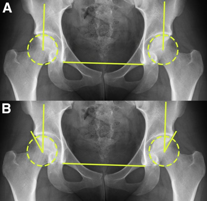 Fig 5