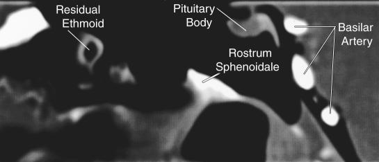 Figure 6A