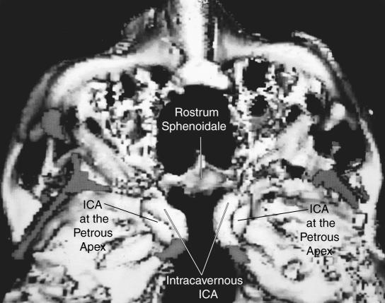 Figure 6B