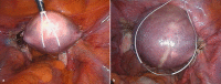 Fig. 2 a