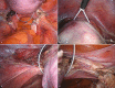 Fig. 3 a