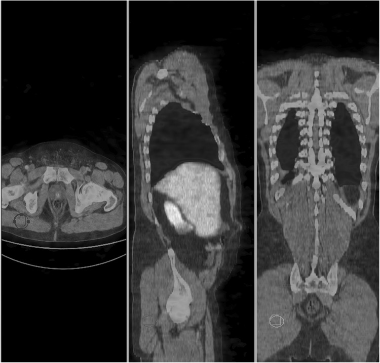 FIG. 3.