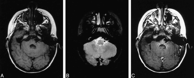 fig 1.