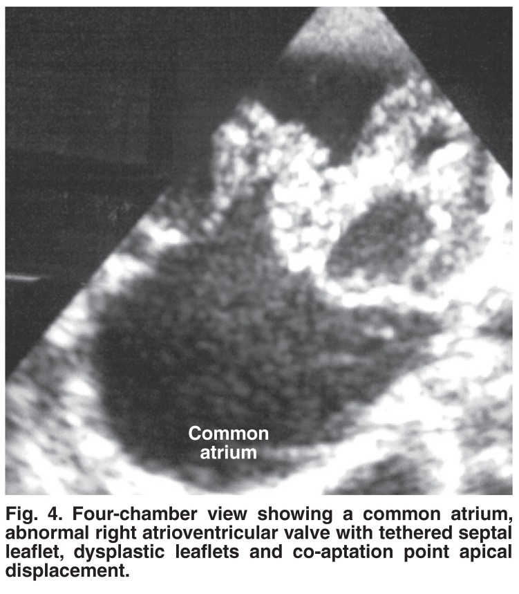 Fig. 4.