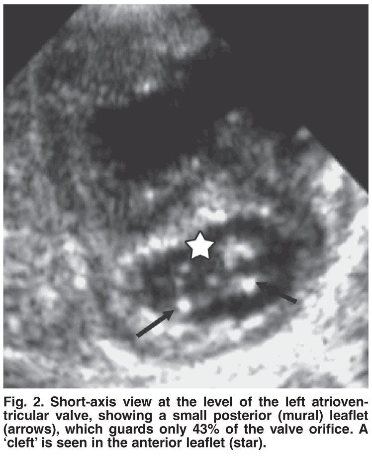 Fig. 2.