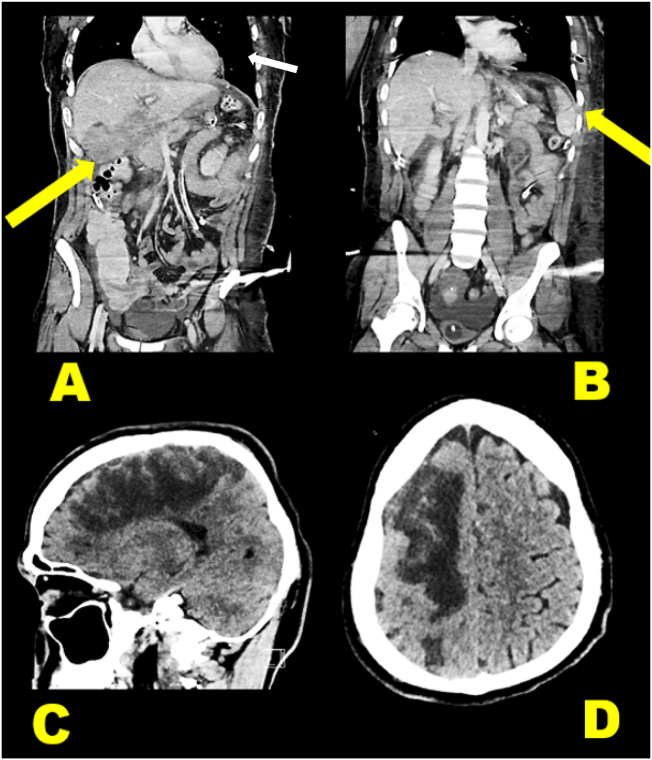 Fig. 1