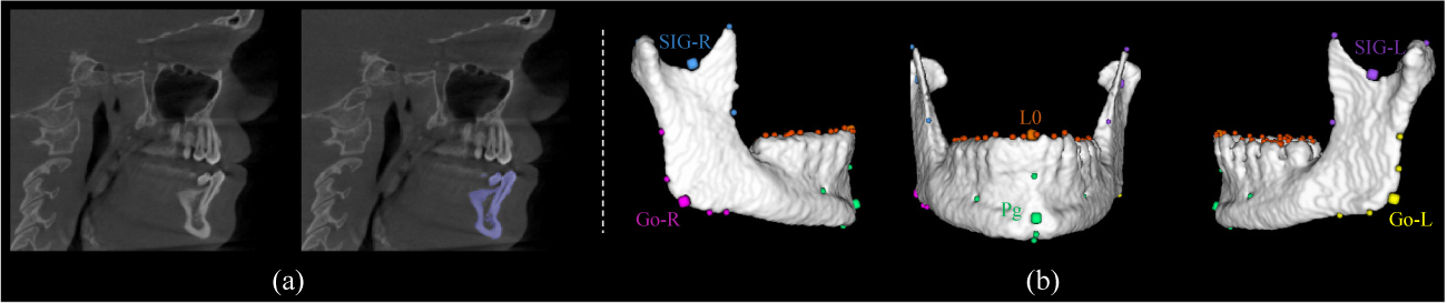 Fig.2.