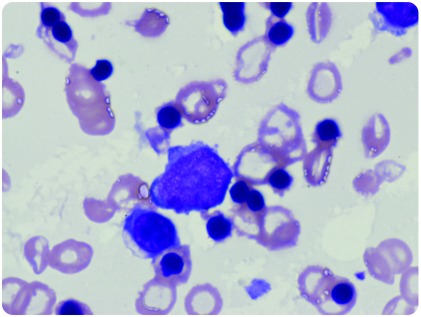 graphic file with name blood879064f1.jpg