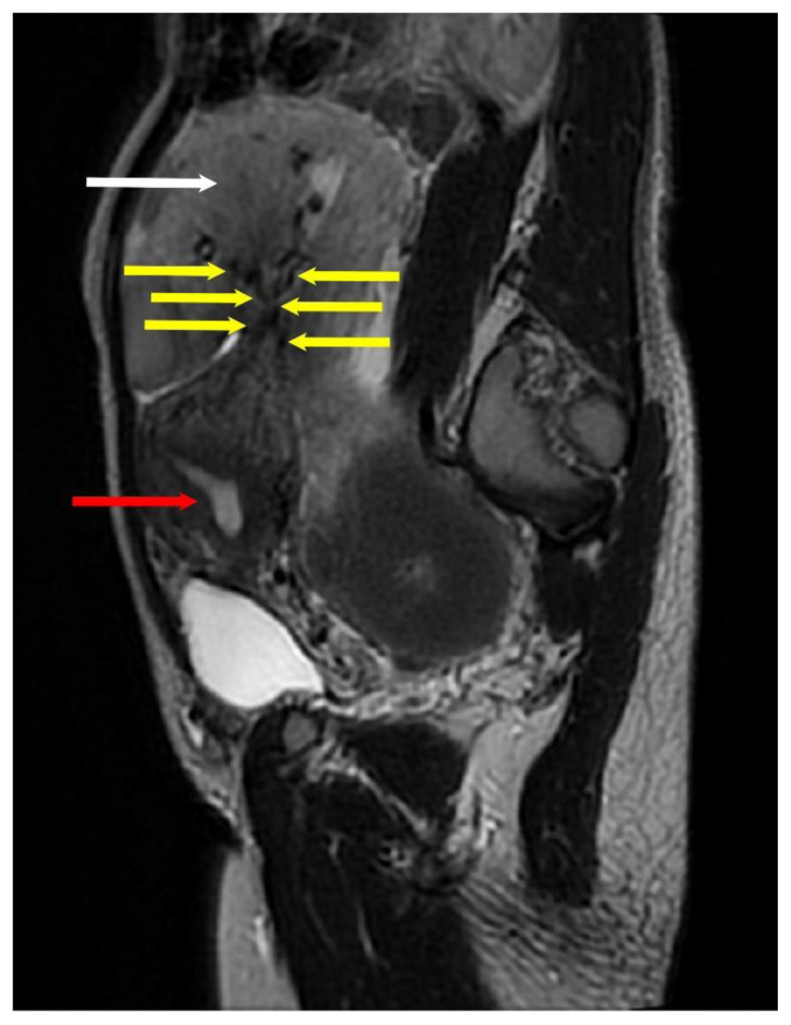 Figure 9