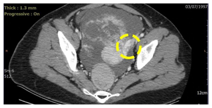 Figure 10