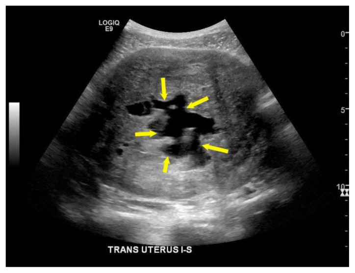 Figure 11