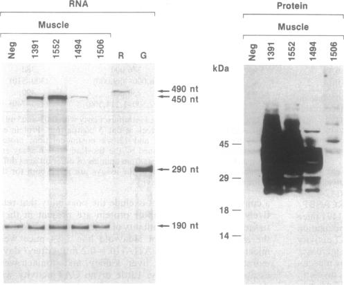 graphic file with name pnas01145-0494-a.jpg