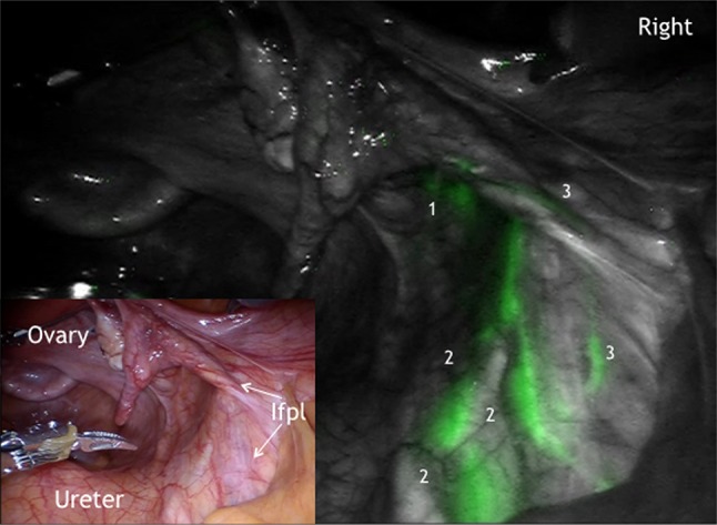 Fig. 2