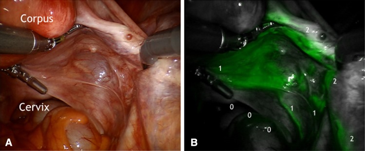 Fig. 1