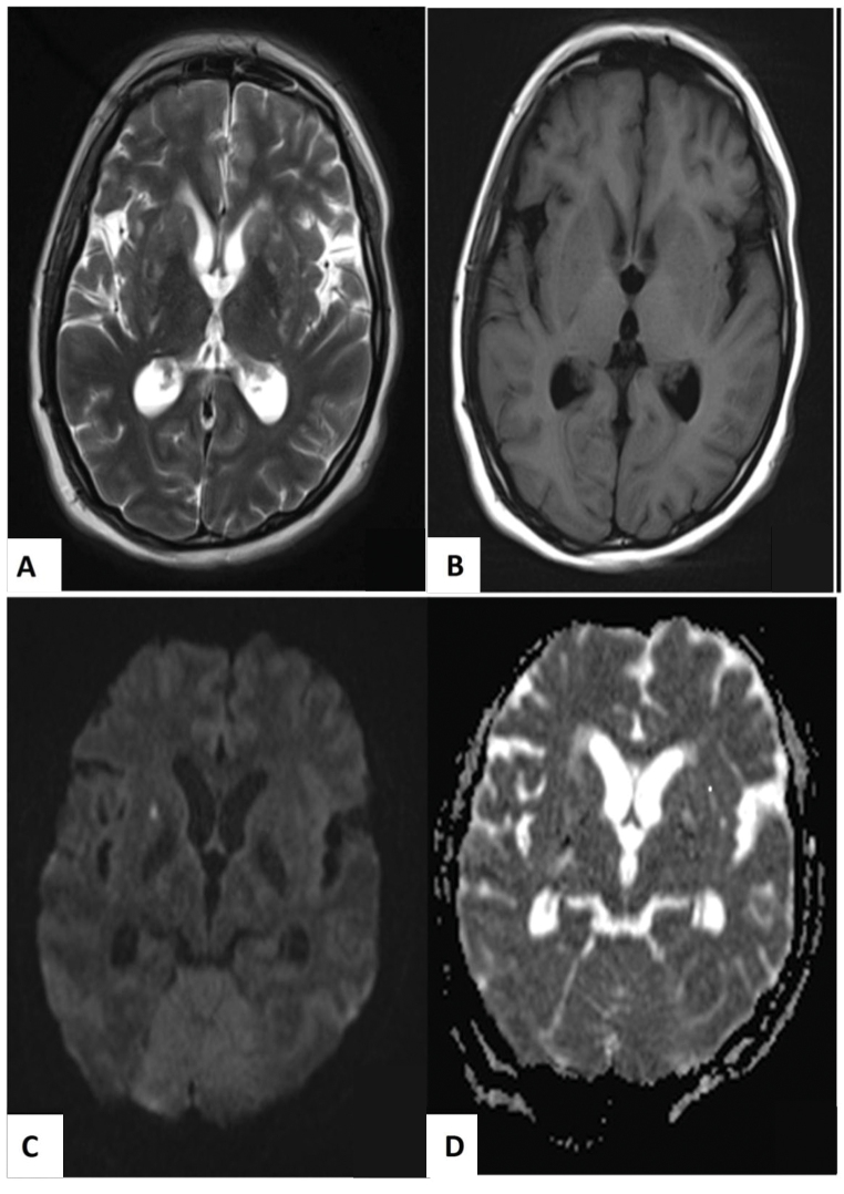 Fig. 1