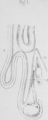 90-1