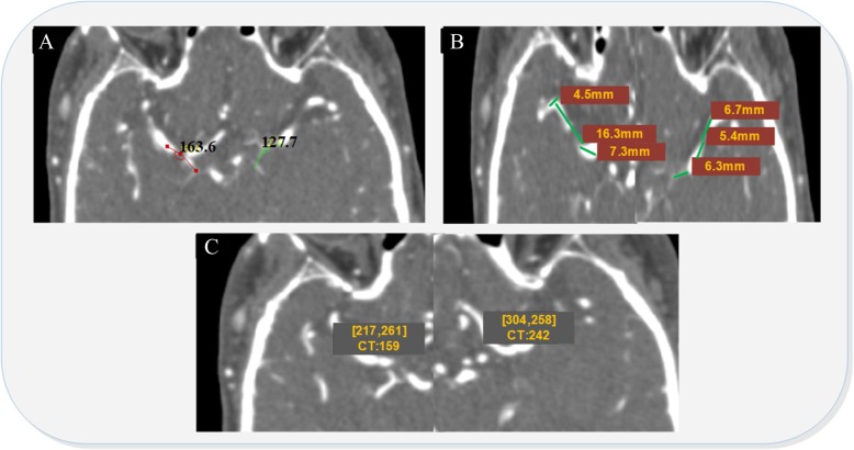 Fig. 3