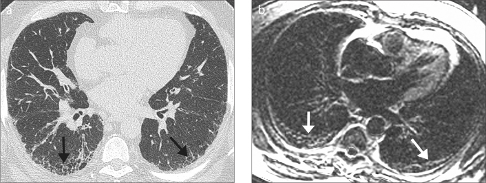 Figure 3. a, b