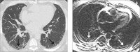 Figure 3. a, b