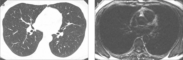 Figure 1. a, b