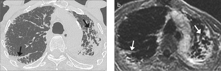 Figure 2. a, b