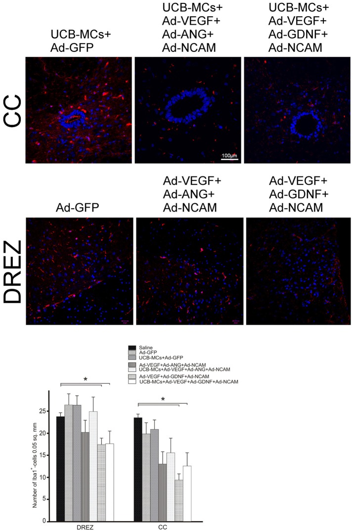 Figure 11