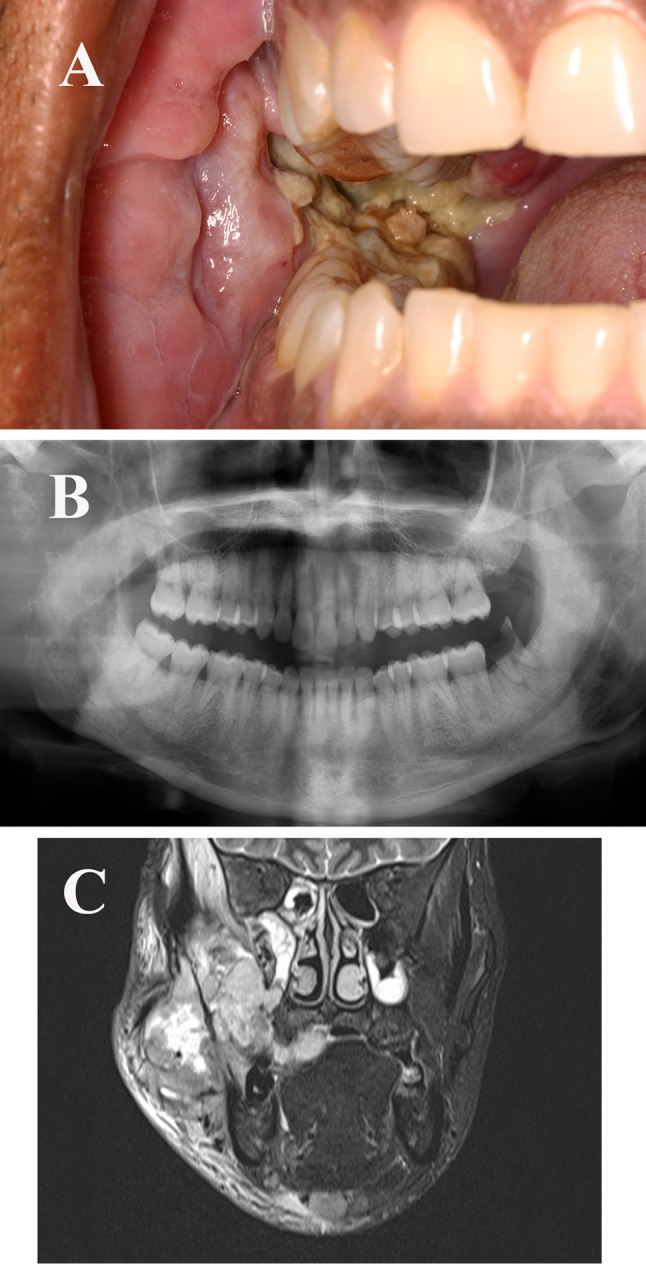 Fig. 1