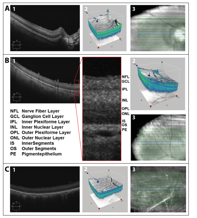 Fig. 1