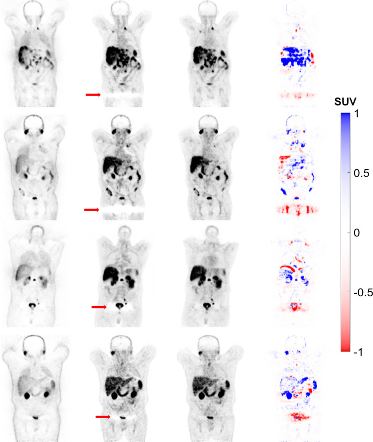 Fig. 4