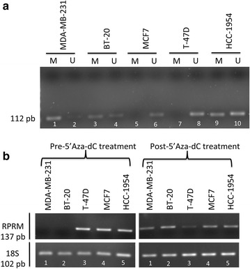 Reprimo as a modulator of cell migration and invasion in the MDA-MB-231 ...