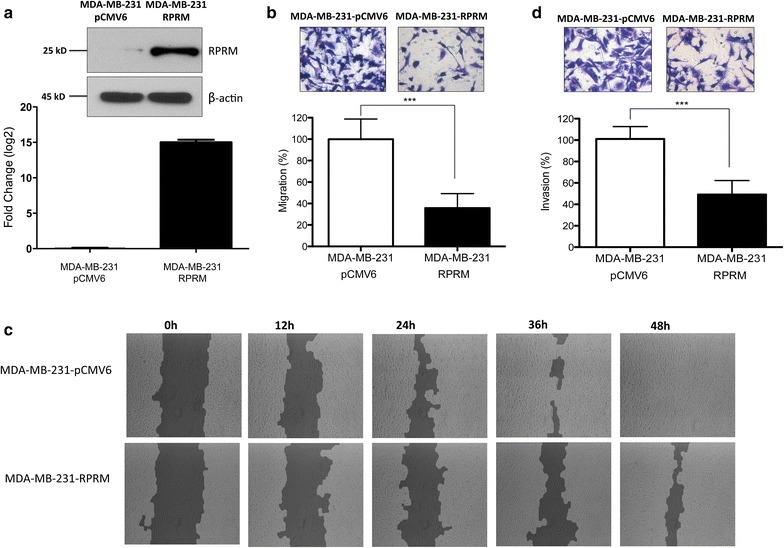 Reprimo as a modulator of cell migration and invasion in the MDA-MB-231 ...