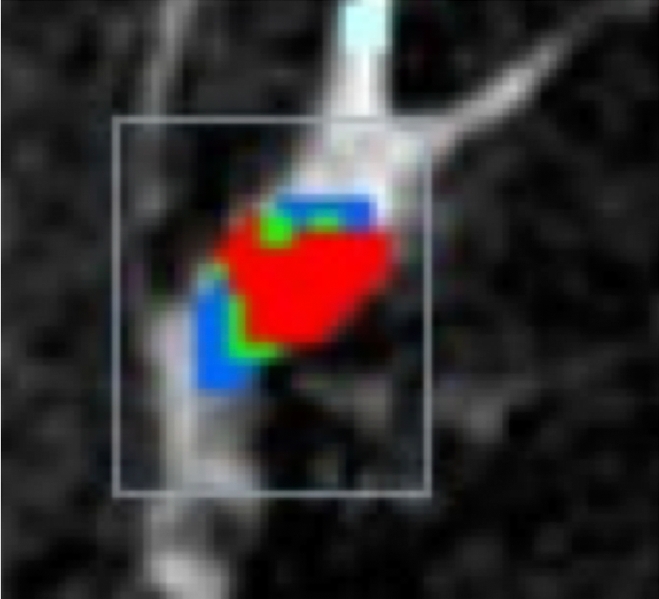 Figure 1b: