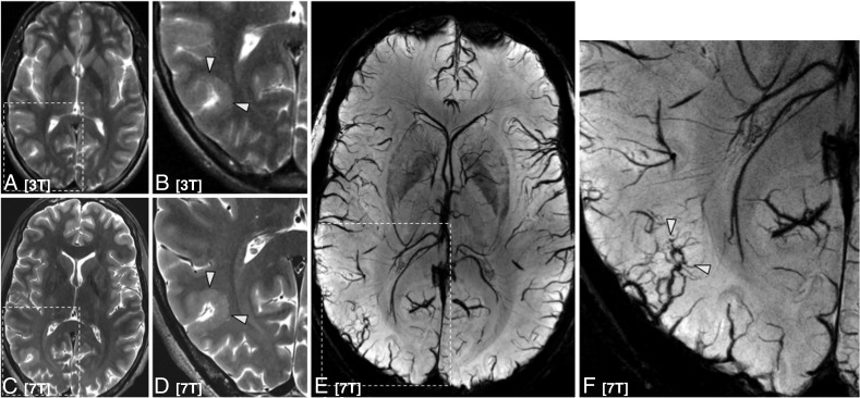 Fig 2.